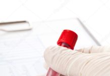 Почему нужно знать свой резус-фактор и группу крови